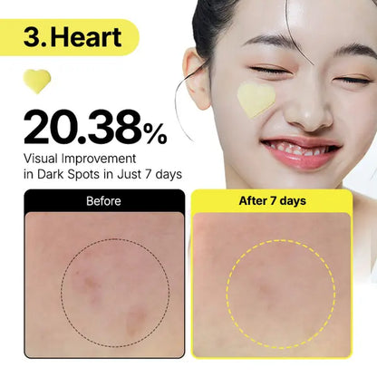 [Manyo] Glutathione 7 Dark Spot Serum Patch — Brightening Hydrogel Spot Patch for Face, Dark Spot Care, Hyperpigmentation & Tone Correction, Korean Skin Care(1 Pack / 2 Pack /3 Pack Available)