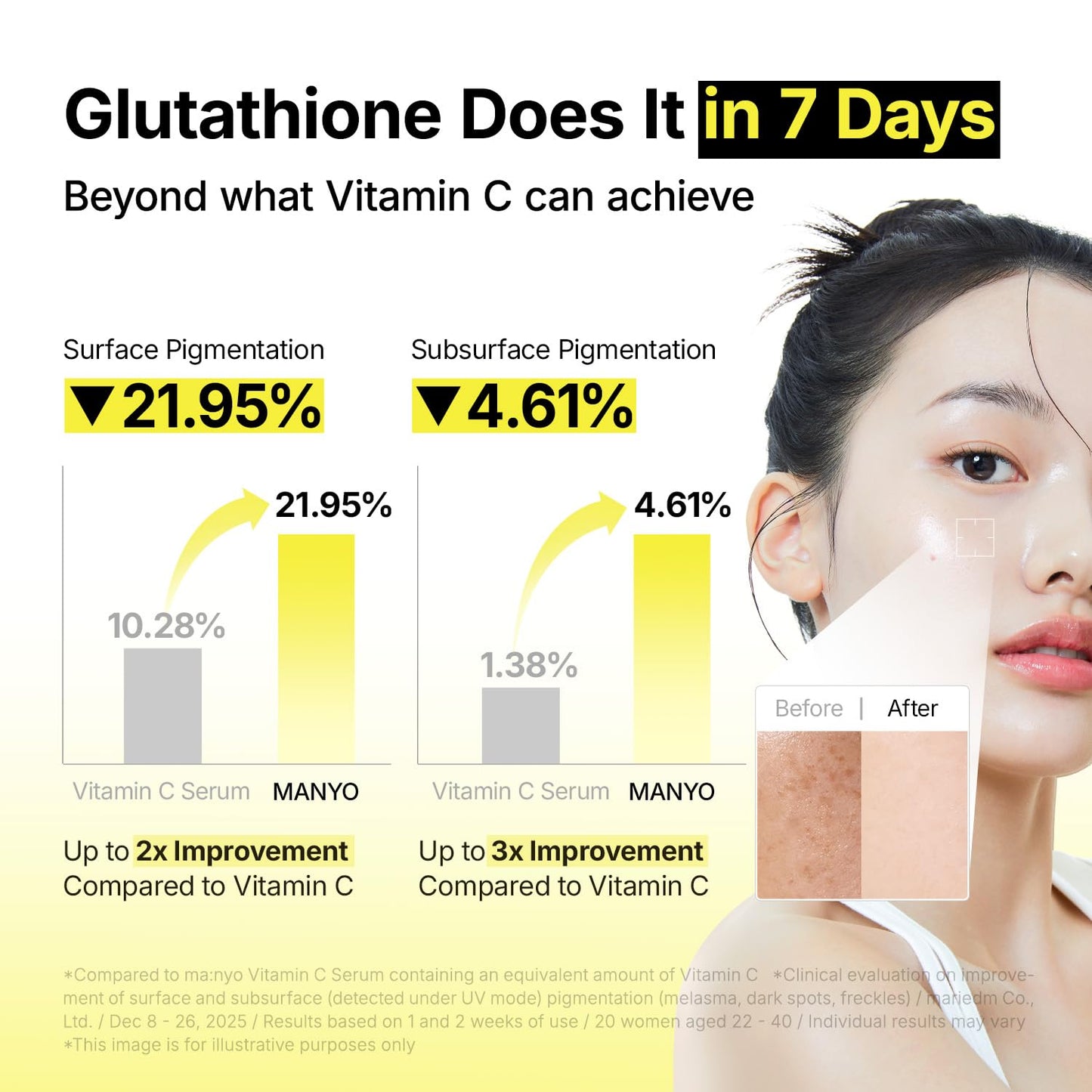 MANYO Glutathione 7 Dark Spot Serum, Niacinamide Serum for Uneven Skin Tone, Dark Spot Remover for Face & Radiance Booster, Korean Skincare, 1.01 Fl.Oz (30Ml)